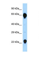 RAG2 / RAG-2 Antibody - RAG2 antibody Western blot of Fetal Lung lysate. Antibody concentration 1 ug/ml.  This image was taken for the unconjugated form of this product. Other forms have not been tested.
