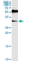 RAG2 / RAG-2 Antibody - RAG2 monoclonal antibody (M06), clone 2G8. Western Blot analysis of RAG2 expression in rat liver.