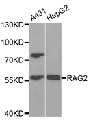 RAG2 / RAG-2 Antibody - Western blot analysis of extracts of various cell lines.