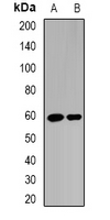 RAG2 / RAG-2 Antibody - Western blot analysis of RAG-2 expression in A431 (A); HepG2 (B) whole cell lysates.