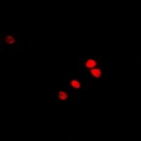 RAG2 / RAG-2 Antibody - Immunofluorescent analysis of RAG-2 staining in U2OS cells. Formalin-fixed cells were permeabilized with 0.1% Triton X-100 in TBS for 5-10 minutes and blocked with 3% BSA-PBS for 30 minutes at room temperature. Cells were probed with the primary antibody in 3% BSA-PBS and incubated overnight at 4 deg C in a humidified chamber. Cells were washed with PBST and incubated with a DyLight 594-conjugated secondary antibody (red) in PBS at room temperature in the dark.