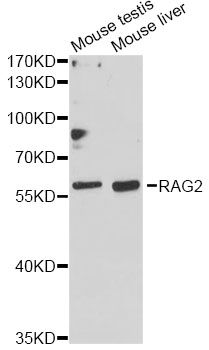 RAG2 / RAG-2 Antibody - Western blot analysis of extracts of various cell lines, using RAG2 antibody at 1:1000 dilution. The secondary antibody used was an HRP Goat Anti-Rabbit IgG (H+L) at 1:10000 dilution. Lysates were loaded 25ug per lane and 3% nonfat dry milk in TBST was used for blocking. An ECL Kit was used for detection and the exposure time was 90s.