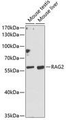 RAG2 / RAG-2 Antibody - Western blot analysis of extracts of various cell lines using RAG2 Polyclonal Antibody at dilution of 1:1000.