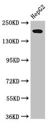 RAI1 Antibody - Western Blot Positive WB detected in:HepG2 whole cell lysate All Lanes:RAI1 antibody at 3µg/ml Secondary Goat polyclonal to rabbit IgG at 1/50000 dilution Predicted band size: 204,199,176,105 KDa Observed band size: 204 KDa