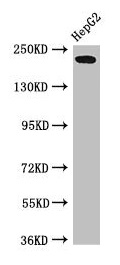 RAI1 Antibody - Western Blot Positive WB detected in: HepG2 whole cell lysate All lanes: RAI1 antibody at 3µg/ml Secondary Goat polyclonal to rabbit IgG at 1/50000 dilution Predicted band size: 204, 199, 176, 105 kDa Observed band size: 204 kDa