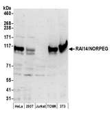RAI14 Antibody - Detection of human and mouse RAI14/NORPEG by western blot. Samples: Whole cell lysate (50 µg) from HeLa, HEK293T, Jurkat, mouse TCMK-1, and mouse NIH 3T3 cells prepared using NETN lysis buffer. Antibody: Affinity purified rabbit anti-RAI14/NORPEG antibody used for WB at 0.1 µg/ml. Detection: Chemiluminescence with an exposure time of 3 minutes.