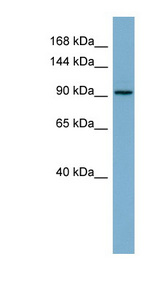 RAI14 Antibody - RAI14 antibody Western blot of COLO205 cell lysate. This image was taken for the unconjugated form of this product. Other forms have not been tested.