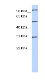 RAI14 Antibody - RAI14 antibody Western blot of MCF7 cell lysate. This image was taken for the unconjugated form of this product. Other forms have not been tested.