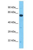 RAI2 Antibody - RAI2 antibody Western Blot of MCF7. Antibody dilution: 1 ug/ml.  This image was taken for the unconjugated form of this product. Other forms have not been tested.