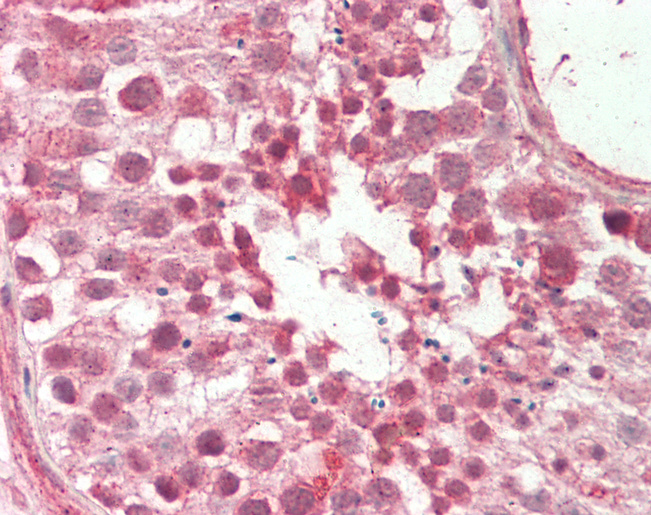 RAIG2 / GPRC5B Antibody - Human Testis: Formalin-Fixed, Paraffin-Embedded (FFPE).  This image was taken for the unconjugated form of this product. Other forms have not been tested.