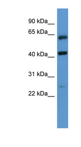 RAIG2 / GPRC5B Antibody - GPRC5B antibody Western blot of Fetal Muscle lysate.  This image was taken for the unconjugated form of this product. Other forms have not been tested.