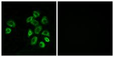 RAIG2 / GPRC5B Antibody - Immunofluorescence analysis of MCF7 cells, using GPRC5B Antibody. The picture on the right is blocked with the synthesized peptide.