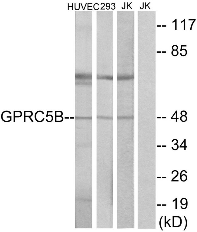 RAIG2 / GPRC5B Antibody - Western blot analysis of lysates from Jurkat, HUVEC, and 293 cells, using GPRC5B Antibody. The lane on the right is blocked with the synthesized peptide.