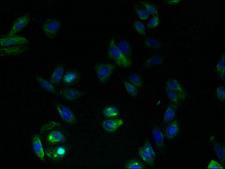 RAIG2 / GPRC5B Antibody - Immunofluorescent analysis of HepG2 cells using GPRC5B Antibody at dilution of 1:100 and Alexa Fluor 488-congugated AffiniPure Goat Anti-Rabbit IgG(H+L)