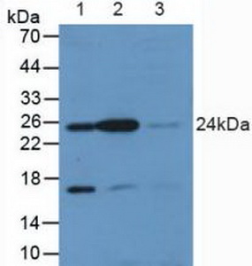 RALA / RAL Antibody - Western Blot; Lane1: Rat Placenta Tissue; Lane2: Rat Brain Tissue; Lane3: Rat Bladder Tissue.