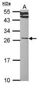 RALA / RAL Antibody - Sample (30 ug of whole cell lysate). A: Hep G2 . 12% SDS PAGE. RALA antibody. RALA / RAL antibody diluted at 1:1000.