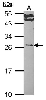 RALA / RAL Antibody - Sample (30 ug of whole cell lysate). A: Hep G2 . 12% SDS PAGE. RALA antibody. RALA / RAL antibody diluted at 1:1000.