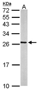 RALA / RAL Antibody - Sample (50 ug of whole cell lysate). A: mouse brain. 12% SDS PAGE. RALA / RAL antibody diluted at 1:500.