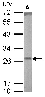RALA / RAL Antibody - RALA antibody detects RALA protein by Western blot analysis. A. 50 ug rat lung lysate/extract. 12 % SDS-PAGE. RALA antibody dilution:1:1000