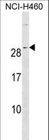 RALA / RAL Antibody - RALA Antibody western blot of NCI-H460 cell line lysates (35 ug/lane). The RALA antibody detected the RALA protein (arrow).
