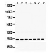 RALA / RAL Antibody - RALA antibody Western blot. All lanes: Anti RALA at 0.5 ug/ml. Lane 1: Rat Brain Tissue Lysate at 50 ug. Lane 2: Rat Thymus Tissue Lysate at 50 ug. Lane 3: Rat Testis Tissue Lysate at 50 ug. Lane 4: Mouse Thymus Tissue Lysate at 50 ug. Lane 5: Mouse Liver Tissue Lysate at 50 ug. Lane 6: HELA Whole Cell Lysate at 40 ug. Lane 7: MCF-7 Whole Cell Lysate at 40 ug. Predicted band size: 24 kD. Observed band size: 24 kD.