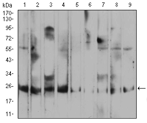 RALA / RAL Antibody - Western blot analysis using RALA mouse mAb against HepG2 (1), MCF-7 (2), A549 (3), K562 (4), Raji (5), MOLT4 (6), Hela (7), COS7 (8), and NIH3T3 (9) cell lysate.