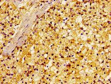 RALA / RAL Antibody - Immunohistochemistry image of paraffin-embedded human adrenal gland tissue at a dilution of 1:100