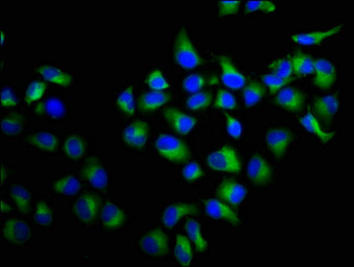 RALA / RAL Antibody - Immunofluorescence staining of Hela cells with RALA Antibody at 1:100, counter-stained with DAPI. The cells were fixed in 4% formaldehyde, permeabilized using 0.2% Triton X-100 and blocked in 10% normal Goat Serum. The cells were then incubated with the antibody overnight at 4°C. The secondary antibody was Alexa Fluor 488-congugated AffiniPure Goat Anti-Rabbit IgG(H+L).