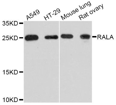 RALA / RAL Antibody - Western blot analysis of extracts of various cell lines, using RALA Antibody at 1:3000 dilution. The secondary antibody used was an HRP Goat Anti-Rabbit IgG (H+L) at 1:10000 dilution. Lysates were loaded 25ug per lane and 3% nonfat dry milk in TBST was used for blocking. An ECL Kit was used for detection and the exposure time was 60s.