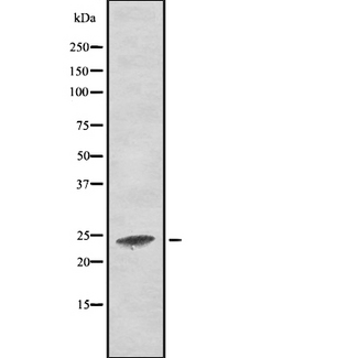RALA / RAL Antibody - Western blot analysis of RALA using MCF-7 whole lysates.