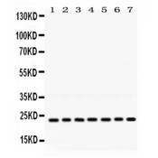 RALB Antibody - RALB antibody Western blot. All lanes: Anti RALB at 0.5 ug/ml. Lane 1: Rat Brain Tissue Lysate at 50 ug. Lane 2: Rat Thymus Tissue Lysate at 50 ug. Lane 3: Rat Lung Tissue Lysate at 50 ug. Lane 4: Mouse Spleen Tissue Lysate at 50 ug. Lane 5: Mouse Liver Tissue Lysate at 50 ug. Lane 6: HELA Whole Cell Lysate at 40 ug. Lane 7: 22RV1 Whole Cell Lysate at 40 ug. Predicted band size: 23 kD. Observed band size: 23 kD.