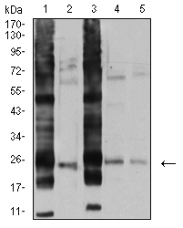 RALB Antibody - Western blot analysis using RALB mouse mAb against A549 (1), U251 (2), HT-29 (3), HEK293 (4), and LOVO (5) cell lysate.