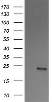 RALB Antibody - HEK293T cells were transfected with the pCMV6-ENTRY control (Left lane) or pCMV6-ENTRY RALB (Right lane) cDNA for 48 hrs and lysed. Equivalent amounts of cell lysates (5 ug per lane) were separated by SDS-PAGE and immunoblotted with anti-RALB.