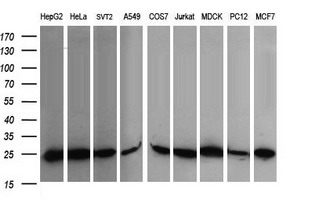 RALB Antibody - Western blot of extracts (35 ug) from 9 different cell lines by using anti-RALB monoclonal antibody (HepG2: human; HeLa: human; SVT2: mouse; A549: human; COS7: monkey; Jurkat: human; MDCK: canine; PC12: rat; MCF7: human).