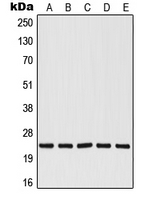 RALB Antibody - Western blot analysis of RALB expression in HepG2 (A); Jurkat (B); A549 (C); NIH3T3 (D); PC12 (E) whole cell lysates.