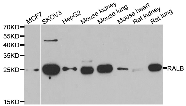 RALB Antibody - Western blot analysis of extracts of various cell lines, using RALB antibody.
