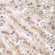 RALB Antibody - Immunohistochemistry of paraffin-embedded human liver injury tissue.