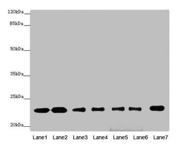 RALB Antibody - Western blot All Lanes: RALBantibody at 1.26ug/ml Lane 1 : Mouse brain tissue Lane 2 : Mouse lung tissue Lane 3 : MCF7 whole cell lysate Lane 4 : HepG-2 whole cell lysate Lane 5 : Jurkat whole cell lysate Lane 6 : NIH/3T3 whole cell lysate Lane 7 : Hela whole cell lysate Secondary Goat polyclonal to Rabbit IgG at 1/10000 dilution Predicted band size: 24,26 kDa Observed band size: 23 kDa