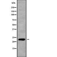 RALB Antibody - Western blot analysis of RALB using K562 whole cells lysates