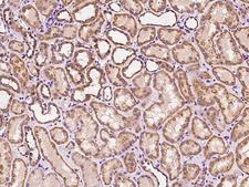 RALB Antibody - Immunochemical staining of human RALB in human kidney with rabbit polyclonal antibody at 1:100 dilution, formalin-fixed paraffin embedded sections.