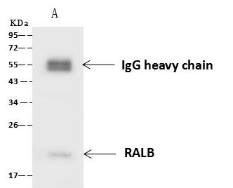 RALB Antibody - RALB was immunoprecipitated using: Lane A: 0.5 mg HepG2 Whole Cell Lysate. 4 uL anti-RALB rabbit polyclonal antibody and 60 ug of Immunomagnetic beads Protein A/G. Primary antibody: Anti-RALB rabbit polyclonal antibody, at 1:100 dilution. Secondary antibody: Goat Anti-Rabbit IgG (H+L)/HRP at 1/10000 dilution. Developed using the ECL technique. Performed under reducing conditions. Predicted band size: 23 kDa. Observed band size: 20 kDa.