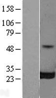 RALB Protein - Western validation with an anti-DDK antibody * L: Control HEK293 lysate R: Over-expression lysate