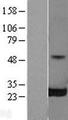 RALB Protein - Western validation with an anti-DDK antibody * L: Control HEK293 lysate R: Over-expression lysate