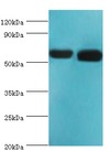 RALDH2 / ALDH1A2 Antibody - Western blot. All lanes: Retinal dehydrogenase 2 antibody at 14 ug/ml. Lane 1: K562 whole cell lysate. Lane 2: mouse liver tissue. Secondary antibody: Goat polyclonal to rabbit at 1:10000 dilution. Predicted band size: 57 kDa. Observed band size: 57 kDa.