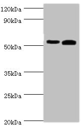 RALDH2 / ALDH1A2 Antibody - Western blot All lanes: Retinal dehydrogenase 2 antibody at 14µg/ml Lane 1: K562 whole cell lysate Lane 2: Mouse liver tissue Secondary Goat polyclonal to rabbit IgG at 1/10000 dilution Predicted band size: 57, 54, 55, 47 kDa Observed band size: 57 kDa