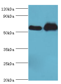 RALDH2 / ALDH1A2 Antibody - Western blot. All lanes: Retinal dehydrogenase 2 antibody at 9 ug/ml. Lane 1: K562 whole cell lysate. Lane 2: mouse liver tissue. Secondary antibody: Goat polyclonal to rabbit at 1:10000 dilution. Predicted band size: 57 kDa. Observed band size: 57 kDa Immunohistochemistry.
