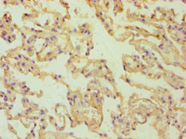 RALDH2 / ALDH1A2 Antibody - Immunohistochemistry of paraffin-embedded human lung tissue using antibody at 1:100 dilution.