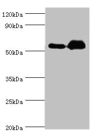 RALDH2 / ALDH1A2 Antibody - Western blot All lanes: Retinal dehydrogenase 2 antibody at 9µg/ml Lane 1: K562 whole cell lysate Lane 2: Mouse liver tissue Secondary Goat polyclonal to rabbit IgG at 1/10000 dilution Predicted band size: 57, 54, 55, 47 kDa Observed band size: 57 kDa