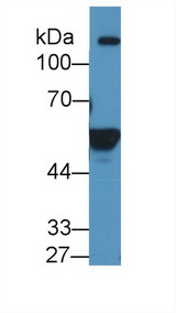 RALDH2 / ALDH1A2 Antibody - Western Blot; Sample: Human K562 cell lysate; Primary Ab: 1µg/ml Rabbit Anti-Human ALDH1A2 Antibody Second Ab: 0.2µg/mL HRP-Linked Caprine Anti-Rabbit IgG Polyclonal Antibody