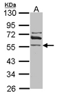 RALDH2 / ALDH1A2 Antibody - Sample (30 ug of whole cell lysate). A: IMR32. 10% SDS PAGE. RALDH2 / ALDH1A2 antibody diluted at 1:1000.